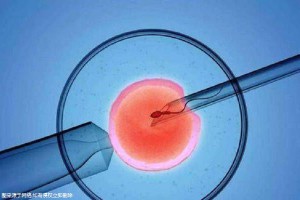锦书生殖